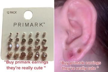 I bought cute earrings from Primark but they left my ears with huge holes
